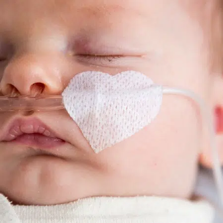 Baby with a breathing tube